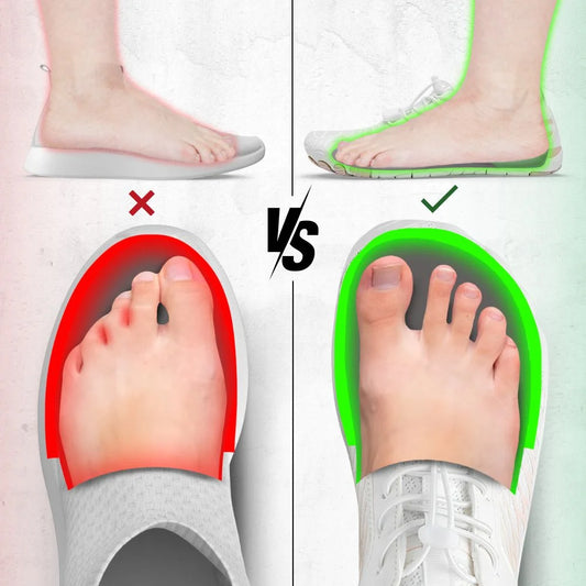 10 Raisons pour lesquelles ces chaussures pieds nus sont indispensables pour soulager la neuropathie en 2024